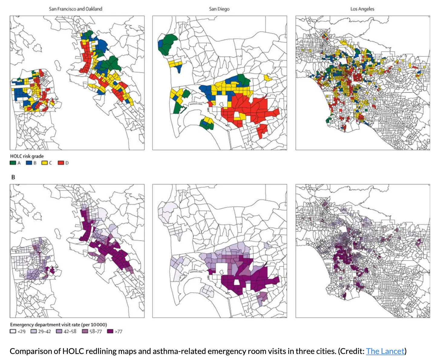 Holc Redlining地图和哮喘相关的急诊室参观三个城市的比较。（信用：柳叶刀）